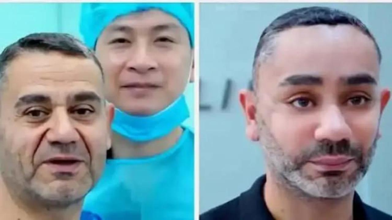58 yaşında gençleşmek istedi, Vietnam'a gitti! Türk uzmandan olay estetik yorumu